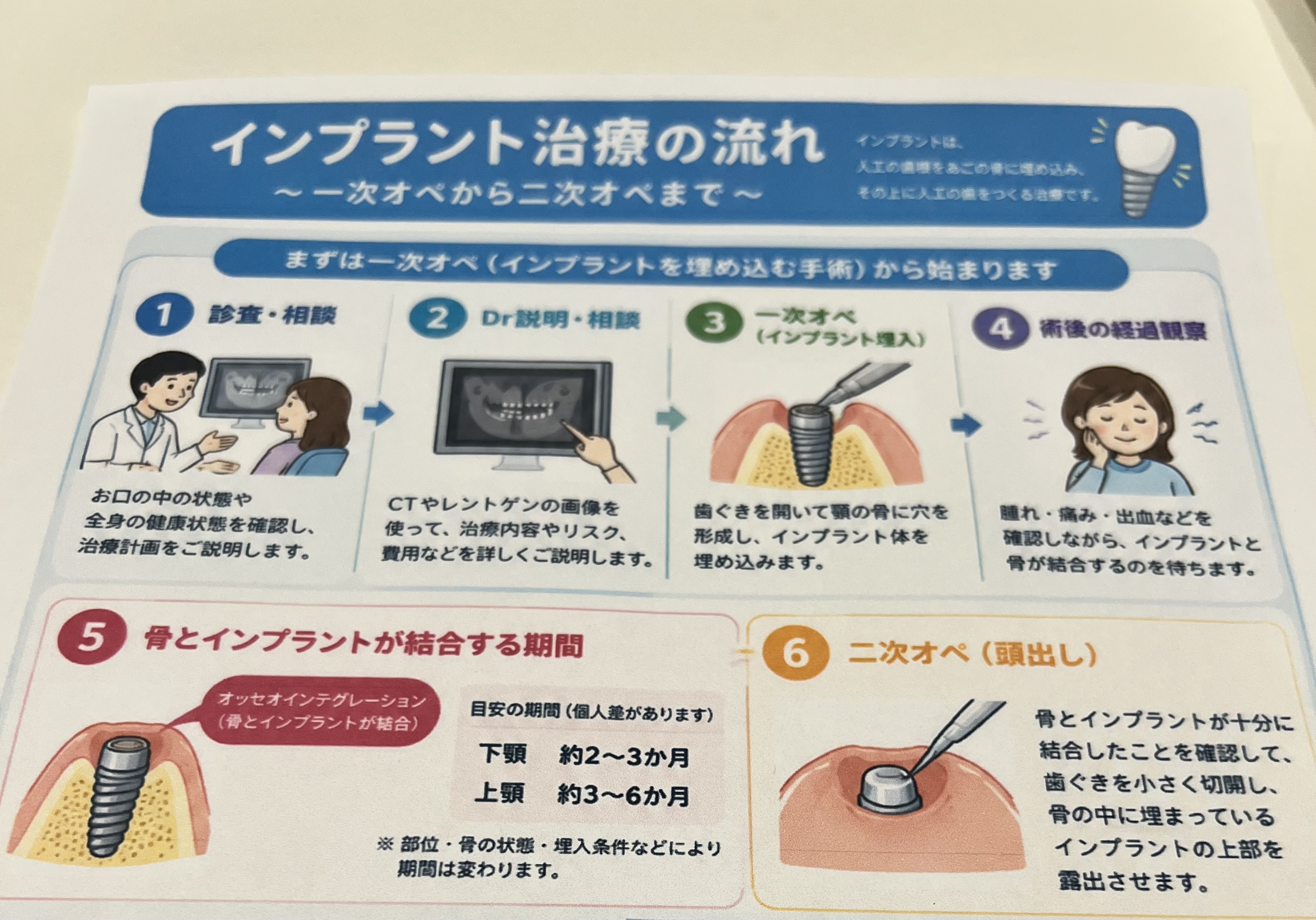 インプラントの治療の流れ